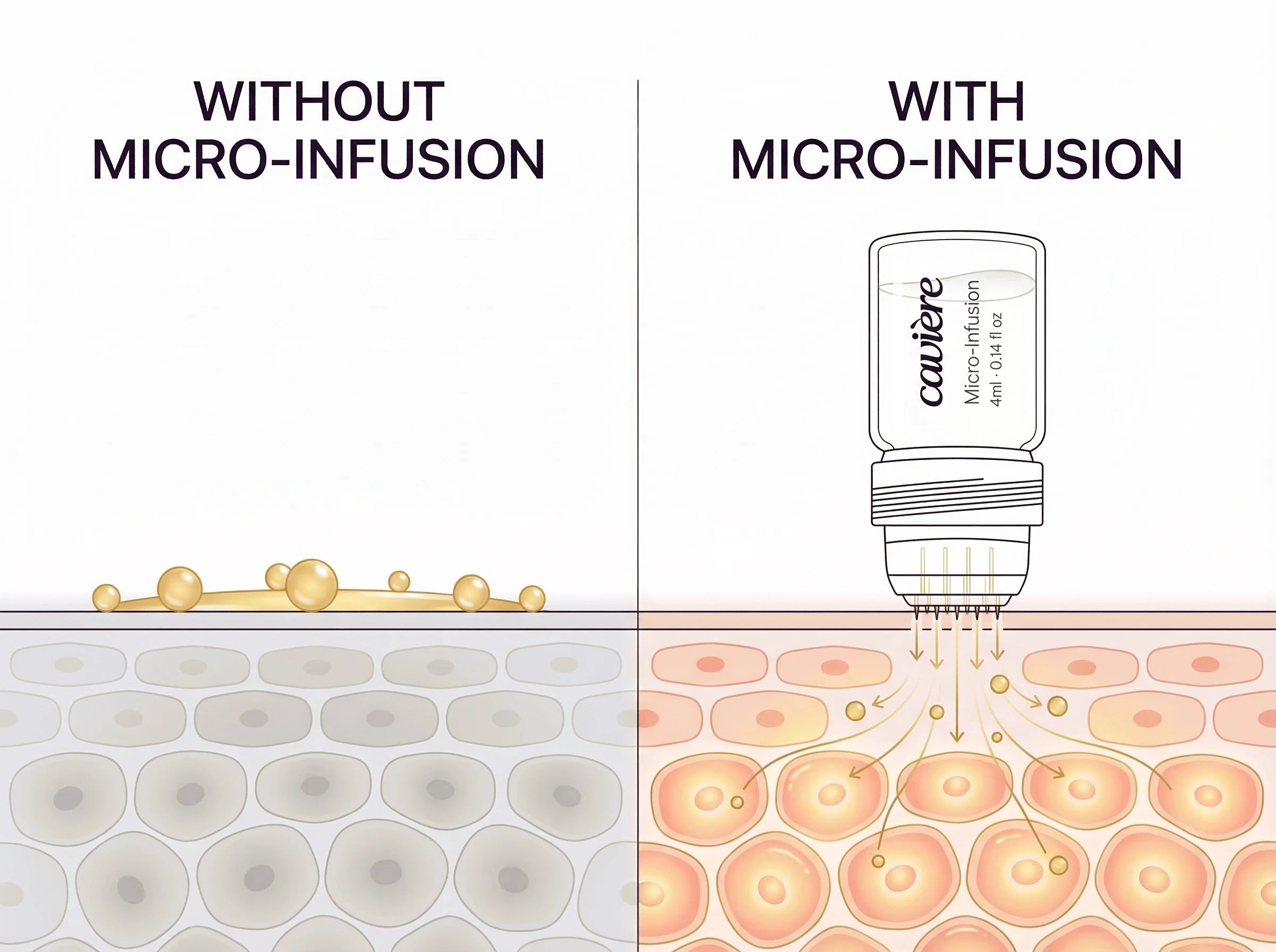 Micro-infusion vs traditional skincare comparison
