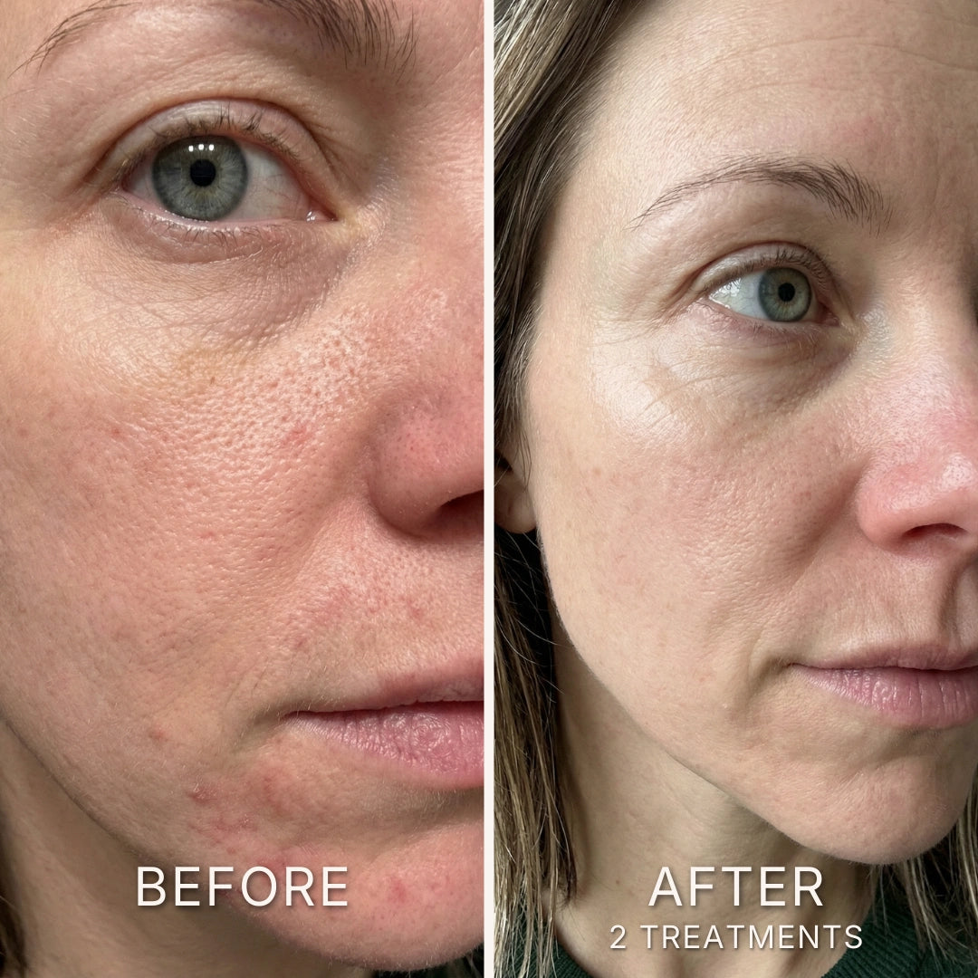 Before and after results